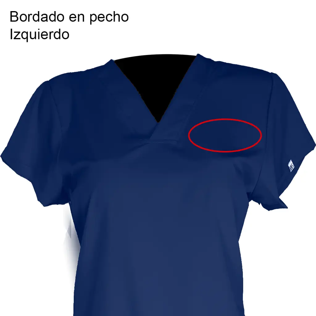 Pecho izquierdo.webp